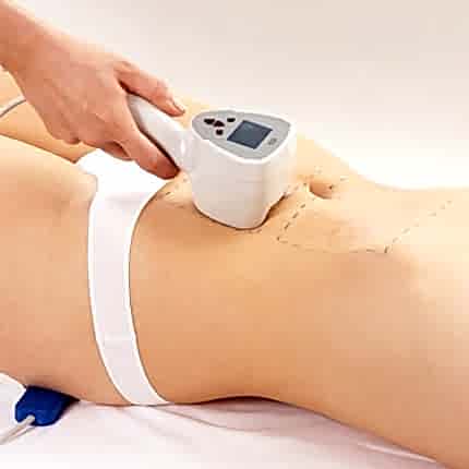 BTL Exilis Ankara