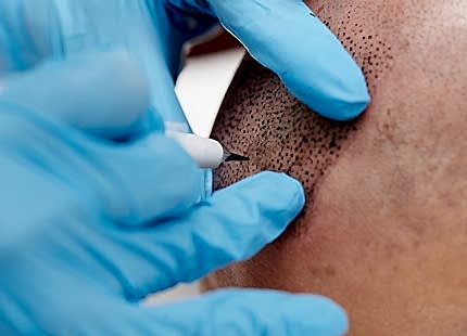 Saç Simülasyonu Sonrası Bakım ve Yıkama