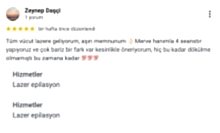 Tüm vücut lazere geliyorum, aşırı memnunum.